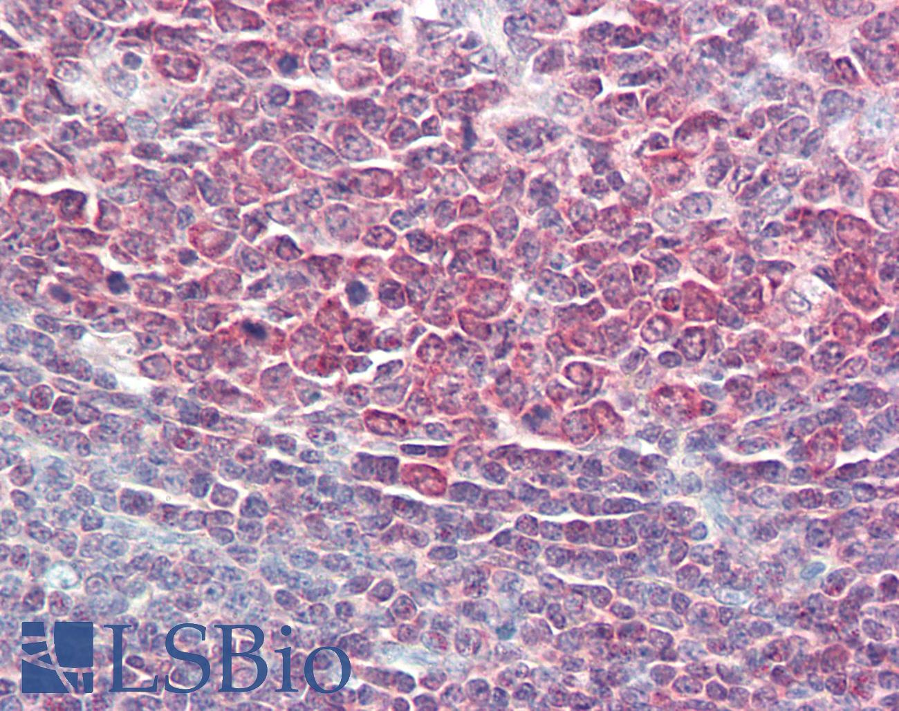 PPP1R10 / PNUTS Antibody - Anti-PPP1R10 / PNUTS antibody IHC staining of human tonsil. Immunohistochemistry of formalin-fixed, paraffin-embedded tissue after heat-induced antigen retrieval. Antibody concentration 5 ug/ml.