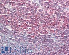 PPP1R10 / PNUTS Antibody - Anti-PPP1R10 / PNUTS antibody IHC staining of human tonsil. Immunohistochemistry of formalin-fixed, paraffin-embedded tissue after heat-induced antigen retrieval. Antibody concentration 5 ug/ml.