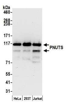 PPP1R10 / PNUTS Antibody - Detection of human PNUTS by western blot. Samples: Whole cell lysate (15 µg) from HeLa, HEK293T, and Jurkat cells prepared using NETN lysis buffer. Antibody: Affinity purified rabbit anti-PNUTS antibody used for WB at 0.1 µg/ml. Detection: Chemiluminescence with an exposure time of 30 seconds.