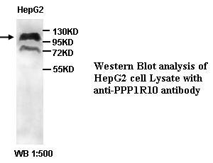 PPP1R10 / PNUTS Antibody