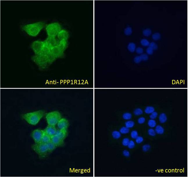 PPP1R12A / MYPT1 Antibody - PPP1R12A / MYPT1 antibody immunofluorescence analysis of paraformaldehyde fixed A431 cells, permeabilized with 0.15% Triton. Primary incubation 1hr (10ug/ml) followed by Alexa Fluor 488 secondary antibody (4ug/ml), showing cytoplasmic staining. The nuclear stain is DAPI (blue). Negative control: Unimmunized goat IgG (10ug/ml) followed by Alexa Fluor 488 secondary antibody (2ug/ml).