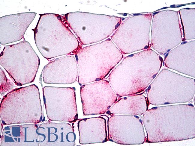 PPP1R13L / iASPP Antibody - Anti-PPP1R13L / IASPP antibody IHC of human skeletal muscle. Immunohistochemistry of formalin-fixed, paraffin-embedded tissue after heat-induced antigen retrieval. Antibody concentration 5 ug/ml.