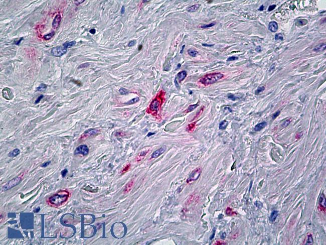 PPP1R13L / iASPP Antibody - Anti-PPP1R13L / IASPP antibody IHC of human prostate, stroma. Immunohistochemistry of formalin-fixed, paraffin-embedded tissue after heat-induced antigen retrieval. Antibody concentration 5 ug/ml.
