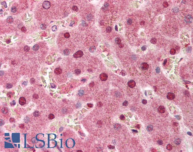 PPP1R13L / iASPP Antibody - Anti-PPP1R13L / IASPP antibody IHC of human liver. Immunohistochemistry of formalin-fixed, paraffin-embedded tissue after heat-induced antigen retrieval. Antibody concentration 5 ug/ml.