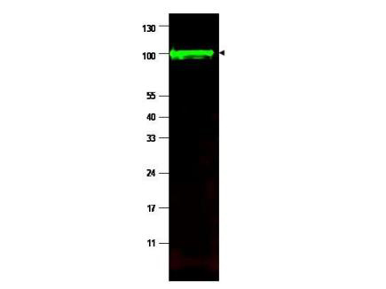 PPP1R13L / iASPP Antibody - Anti-iASPP Antibody - Western Blot. Western blot of affinity purified anti-iASPP antibody shows detection of a band at ~100 kD (arrowhead) corresponding to isoform 1 of iASPP in MCF7 whole cell lysates. Preincubation with immunizing peptide blocks specific band staining (data not shown). Approximately 35 ug of lysate was separated by 4-20% Tris Glycine SDS-PAGE. After blocking, the membrane was probed with the primary antibody diluted to 1:1500 in 5% BLOTTO/PBS overnight at 4C. The membrane was washed and reacted with a 1:10000 dilution of IRDye800 conjugated Gt-a-Rabbit IgG [H&L] ( for 45 min at room temperature (800 nm channel, green). Molecular weight estimation was made by comparison to prestained MW markers. IRDye800 fluorescence image was captured using the Odyssey Infrared Imaging System developed by LI-COR. IRDye is a trademark of LI-COR, Inc. Other detection systems will yield similar results.
