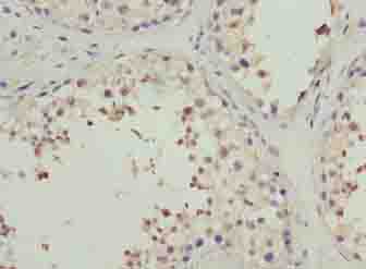 PPP1R14A / CPI-17 Antibody - Immunohistochemistry of paraffin-embedded human testis tissue using antibody at dilution of 1:100.