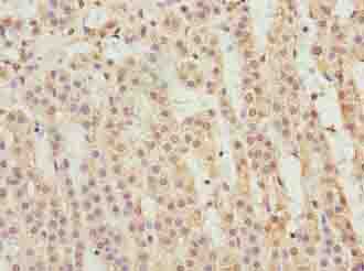 PPP1R14A / CPI-17 Antibody - Immunohistochemistry of paraffin-embedded human adrenal gland tissue using antibody at dilution of 1:100.