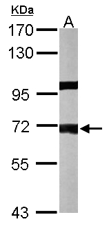 PPP1R16A Antibody - Sample (50 ug of whole cell lysate). A: mouse liver. 7.5% SDS PAGE. PPP1R16A antibody diluted at 1:1000.
