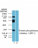 PPP1R1A / IPP1 Antibody - Western blot of IPP-1 in human ovary lysate in the 1) absence and 2) presence of immunizing peptide using antibody at 1 ug/ml.
