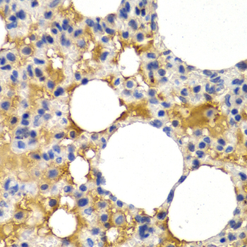 PPP1R1B / DARPP-32 Antibody - Immunohistochemistry of paraffin-embedded rat lung using PPP1R1B antibody at dilution of 1:200 (400x lens).
