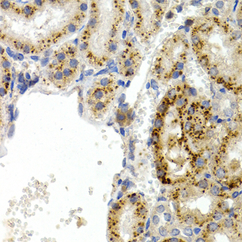 PPP1R1B / DARPP-32 Antibody - Immunohistochemistry of paraffin-embedded rat kidney using PPP1R1B antibody at dilution of 1:200 (400x lens).