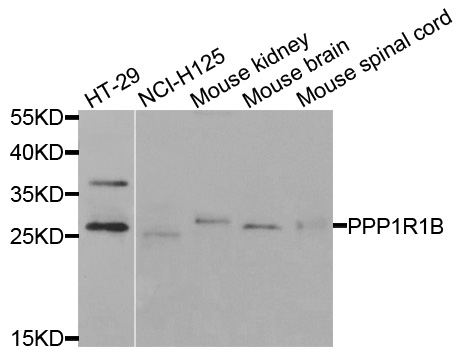 PPP1R1B / DARPP-32 Antibody - Western blot analysis of extracts of various cells.