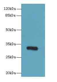 PPP1R3B Antibody - Western blot. All lanes: PPP1R3B antibody at 6 ug/ml+Mos- liver tissue Goat polyclonal to rabbit at 1:10000 dilution. Predicted band size: 33 kDa. Observed band size: 33 kDa.
