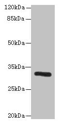 PPP1R3B Antibody - Western blot All lanes: PPP1R3B antibody at 6µg/ml + Mouse liver tissue Secondary Goat polyclonal to rabbit IgG at 1/10000 dilution Predicted band size: 33 kDa Observed band size: 33 kDa