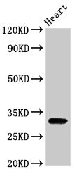 PPP1R3B Antibody - Western Blot Positive WB detected in: Rat heart tissue All lanes: PPP1R3B antibody at 2.5µg/ml Secondary Goat polyclonal to rabbit IgG at 1/50000 dilution Predicted band size: 33 kDa Observed band size: 33 kDa
