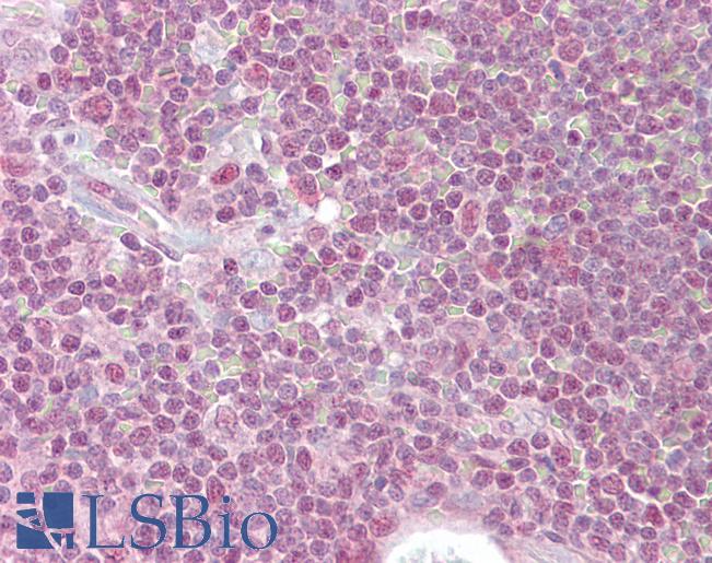 PPP1R8 / Rnase E Antibody - Anti-PPP1R8 antibody IHC of human thymus. Immunohistochemistry of formalin-fixed, paraffin-embedded tissue after heat-induced antigen retrieval. Antibody concentration 2.5 ug/ml.
