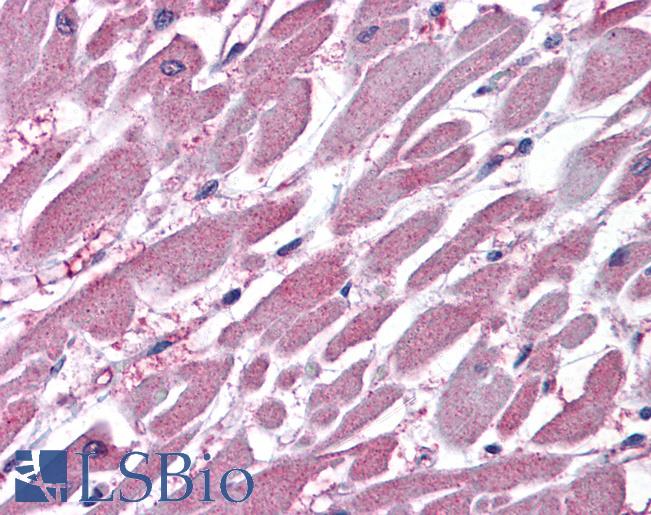 PPP2R1A Antibody - Anti-PPP2R1A antibody IHC of human heart. Immunohistochemistry of formalin-fixed, paraffin-embedded tissue after heat-induced antigen retrieval. Antibody concentration 3.75 ug/ml.