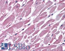 PPP2R1A Antibody - Anti-PPP2R1A antibody IHC of human heart. Immunohistochemistry of formalin-fixed, paraffin-embedded tissue after heat-induced antigen retrieval. Antibody concentration 3.75 ug/ml.
