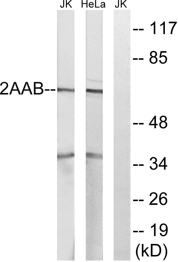 PPP2R1B Antibody - Western blot analysis of lysates from HeLa and Jurkat cells, using PPP2R1B Antibody. The lane on the right is blocked with the synthesized peptide.