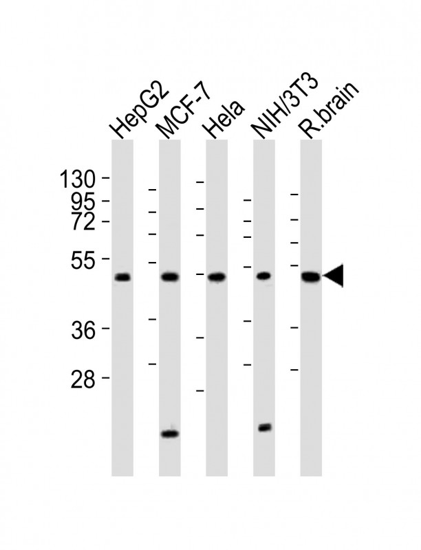 PPP2R2A Antibody - All lanes : Anti-PPP2R2A Antibody at 1:2000 dilution Lane 1: HepG2 whole cell lysates Lane 2: MCF-7 whole cell lysates Lane 3: HeLa whole cell lysates Lane 4: NIH/3T3 whole cell lysates Lane 5: rat brain lysates Lysates/proteins at 20 ug per lane. Secondary Goat Anti-Rabbit IgG, (H+L), Peroxidase conjugated at 1/10000 dilution Predicted band size : 52 kDa Blocking/Dilution buffer: 5% NFDM/TBST.
