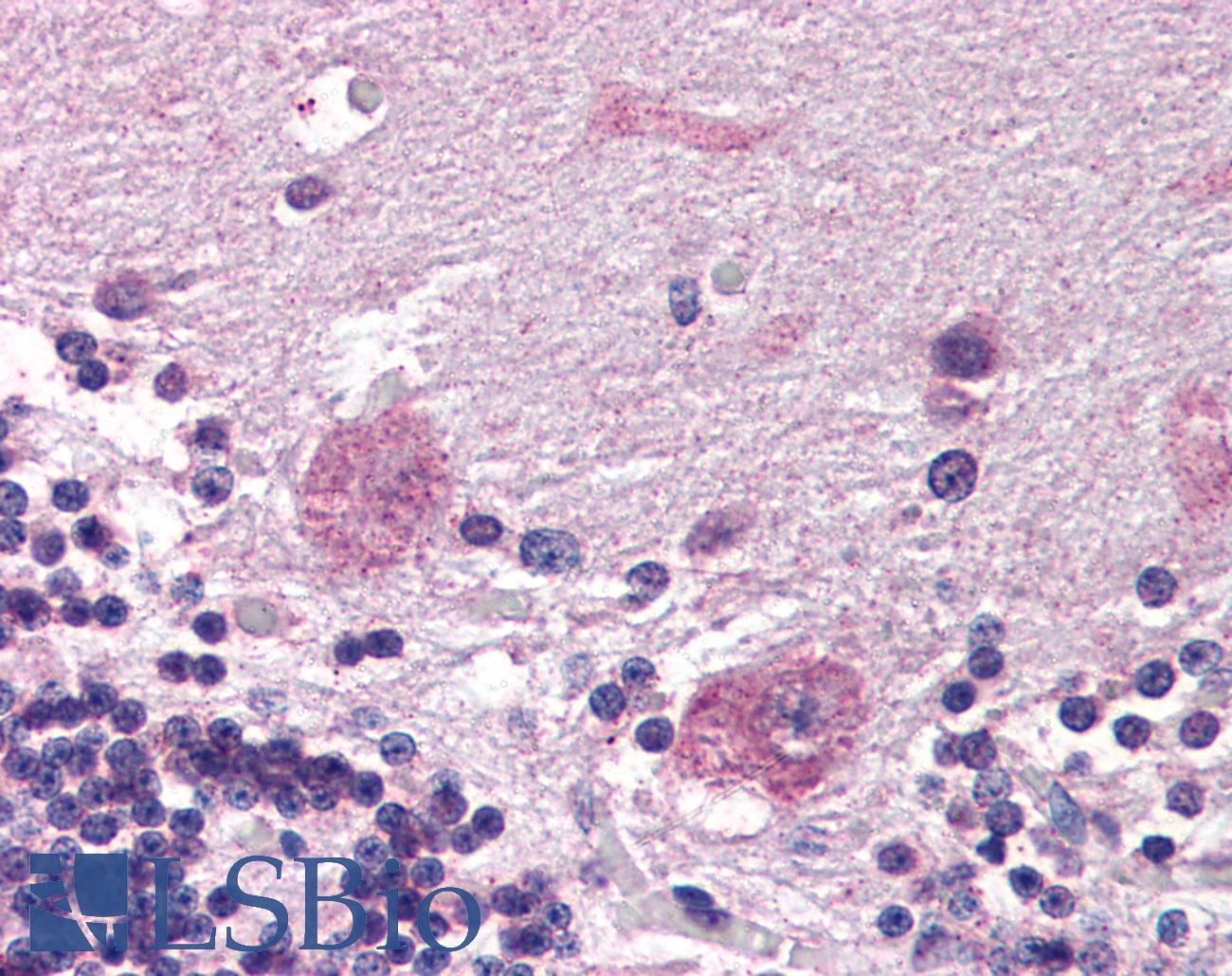 PPP2R3A / PR130 Antibody - Anti-PPP2R3A antibody IHC of human brain, cerebellum. Immunohistochemistry of formalin-fixed, paraffin-embedded tissue after heat-induced antigen retrieval. Antibody concentration 5 ug/ml.