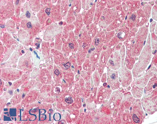 PPP2R5A Antibody - Anti-PPP2R5A antibody IHC staining of human heart. Immunohistochemistry of formalin-fixed, paraffin-embedded tissue after heat-induced antigen retrieval.