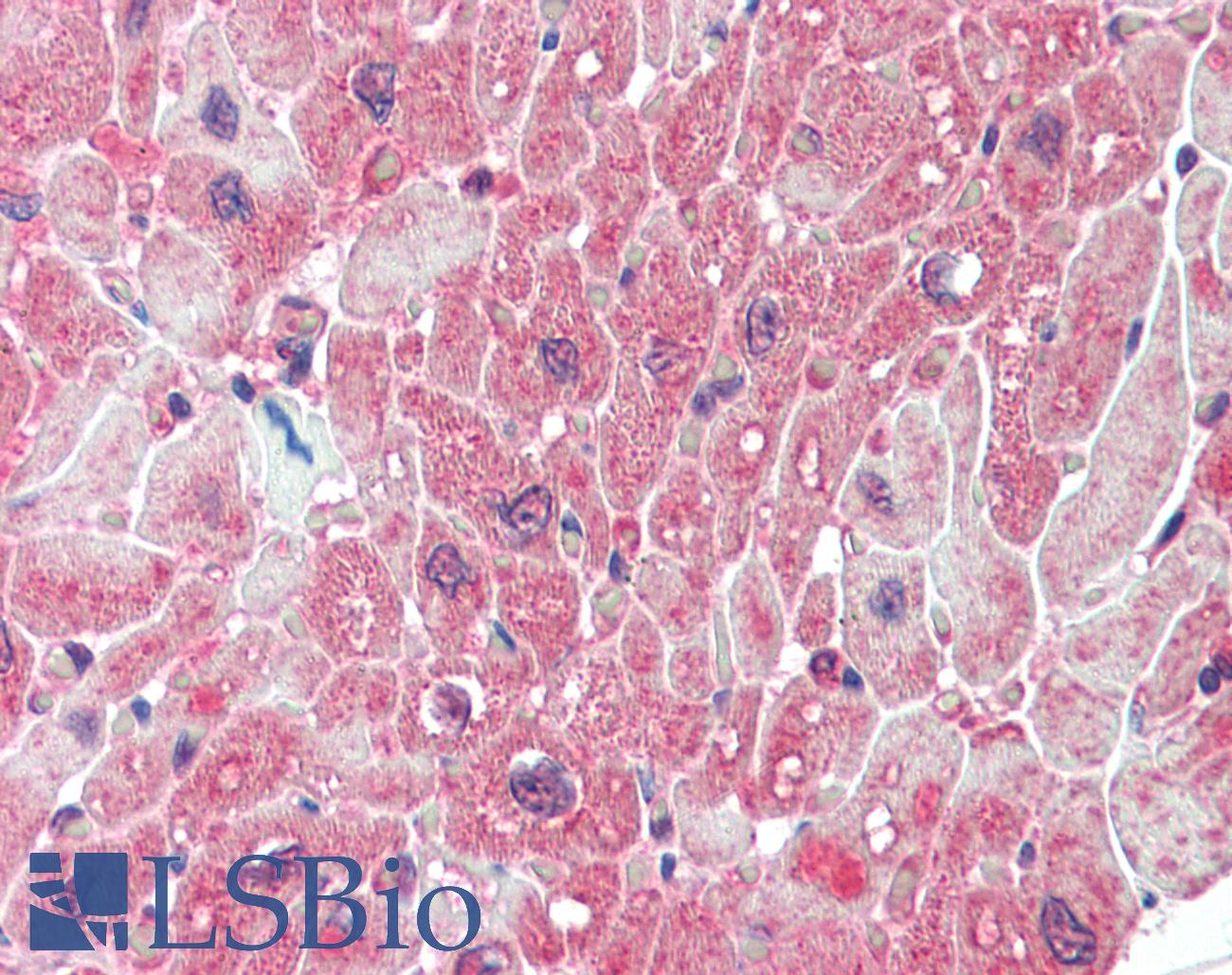 PPP2R5A Antibody - Anti-PPP2R5A antibody IHC staining of human heart. Immunohistochemistry of formalin-fixed, paraffin-embedded tissue after heat-induced antigen retrieval.