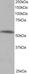 PPP2R5A Antibody - Antibody staining (0.5 ug/ml) of human muscle lysate (RIPA buffer, 35 ug total protein per lane). Primary incubated for 1 hour. Detected by Western blot of chemiluminescence.