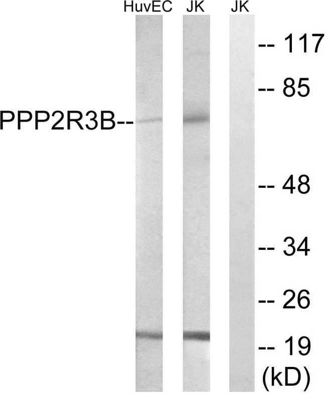 PPP2R5D Antibody - Western blot analysis of lysates from Jurkat and HUVEC cells, using PPP2R5D Antibody. The lane on the right is blocked with the synthesized peptide.