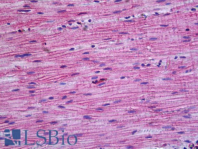 PPP3CA / CCN1 / Calcineurin A Antibody - Anti-PPP3CA / Calcineurin A antibody IHC of human intestine, muscularis propria. Immunohistochemistry of formalin-fixed, paraffin-embedded tissue after heat-induced antigen retrieval. Antibody concentration 5 ug/ml.