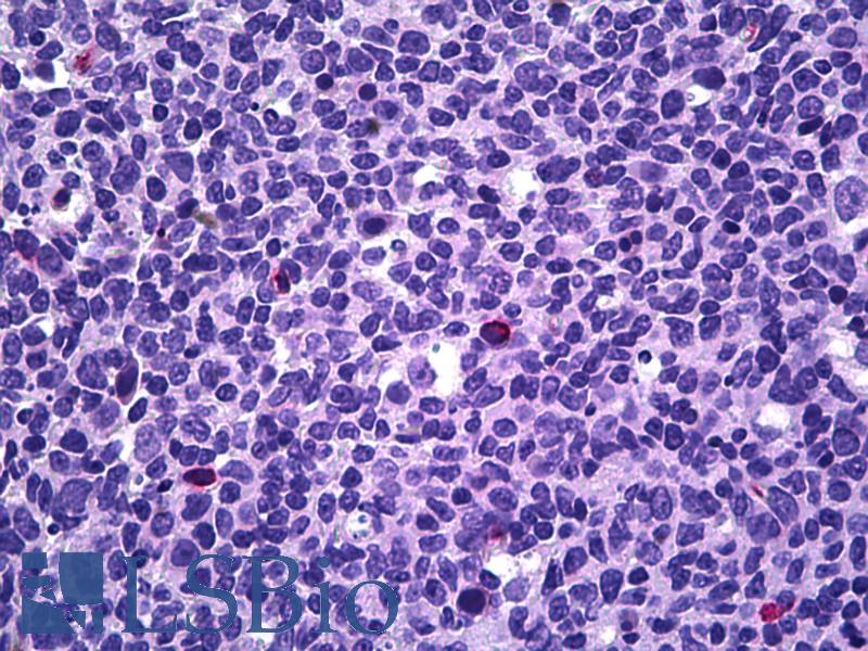 PPP3CA / CCN1 / Calcineurin A Antibody - Anti-PPP3CA / Calcineurin A antibody IHC of human tonsil, lymphocytes. Immunohistochemistry of formalin-fixed, paraffin-embedded tissue after heat-induced antigen retrieval. Antibody concentration 5 ug/ml.