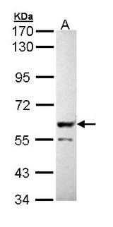 PPP3CB Antibody - Sample (30 ug of whole cell lysate). A: Molt-4 . 7.5% SDS PAGE. PPP3CB antibody diluted at 1:5000.
