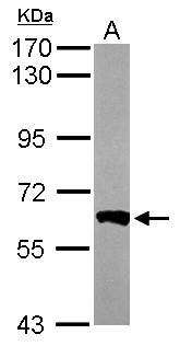 PPP3CB Antibody - Sample (50 ug of whole cell lysate). A: Mouse brain. 7.5% SDS PAGE. PPP3CB antibody diluted at 1:1000.