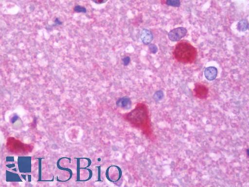 PPP3CB Antibody - Anti-PPP3CB antibody IHC staining of human brain, cortex. Immunohistochemistry of formalin-fixed, paraffin-embedded tissue after heat-induced antigen retrieval. Antibody concentration 7.5 ug/ml.
