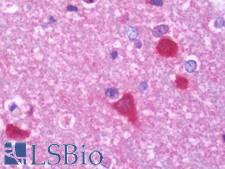 PPP3CB Antibody - Anti-PPP3CB antibody IHC staining of human brain, cortex. Immunohistochemistry of formalin-fixed, paraffin-embedded tissue after heat-induced antigen retrieval. Antibody concentration 7.5 ug/ml.