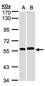 PPP3CB Antibody - Sample (30 ug whole cell lysate). A: A431, B: MOLT4 . 7.5% SDS PAGE. PPP3CB antibody diluted at 1:1000