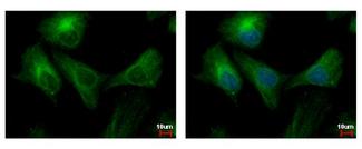 PPP3CB Antibody - PPP3CB antibody detects PPP3CB protein at cytoplasm by immunofluorescent analysis. HeLa cells were fixed in ice-cold MeOH for 5 min. PPP3CB protein stained by PPP3CB antibody diluted at 1:500. 
