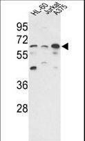 PPP3CC / CALNA3 Antibody - Western blot of hPPP3CC-E33 in HL-60, Jurkat, A375 cell line lysates (35 ug/lane). PPP3CC (arrow) was detected using the purified antibody.