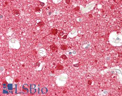 PPP3R1 / Calcineurin B Antibody - Human Brain, Cortex: Formalin-Fixed, Paraffin-Embedded (FFPE)
