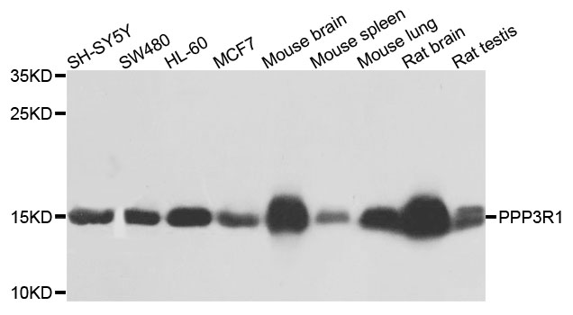 PPP3R1 / Calcineurin B Antibody - Western blot analysis of extracts of various cell lines, using PPP3R1 antibody at 1:1000 dilution. The secondary antibody used was an HRP Goat Anti-Rabbit IgG (H+L) at 1:10000 dilution. Lysates were loaded 25ug per lane and 3% nonfat dry milk in TBST was used for blocking. An ECL Kit was used for detection and the exposure time was 1s.