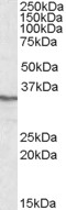 PPP4C Antibody - Antibody (0.3 ug/ml) staining of HEK293 lysate (35 ug protein in RIPA buffer). Primary incubation was 1 hour. Detected by chemiluminescence.