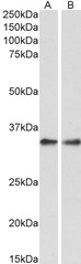 PPP4C Antibody - Goat Anti-PPP4C Antibody (0.3µg/ml) staining of Rat Spleen (A) and Lung (B) lysate (35µg protein in RIPA buffer). Primary incubation was 1 hour. Detected by chemiluminescencence.