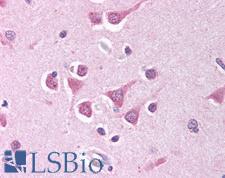 PPP4C Antibody - Anti-PPP4C antibody IHC of human brain, cortex. Immunohistochemistry of formalin-fixed, paraffin-embedded tissue after heat-induced antigen retrieval. Antibody concentration 10 ug/ml.