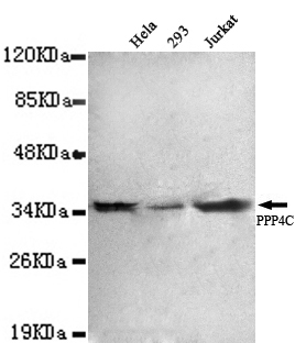PPP4C Antibody - PPP4C antibody at 1:1000 dilution Lane1:HeLa whole cell lysate 40 ug/Lane Lane2: 293 whole cell lysate 40 ug/Lane Lane3: Jurkat whole cell lysate 40 ug/Lane.