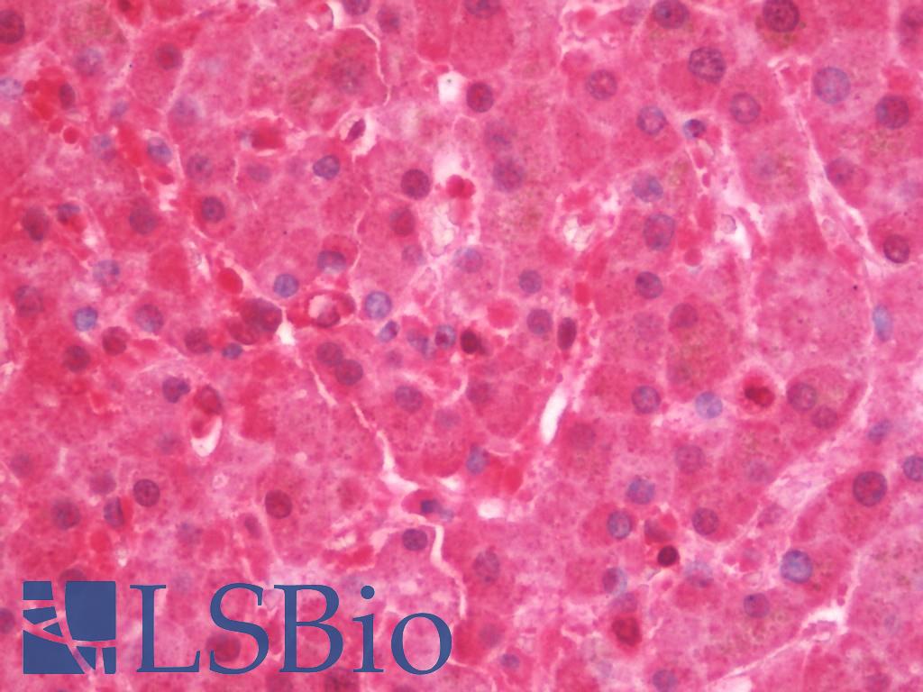 PPP4C Antibody - Anti-PPP4C antibody IHC staining of human liver. Immunohistochemistry of formalin-fixed, paraffin-embedded tissue after heat-induced antigen retrieval. Antibody dilution 1:50.