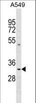 PPT1 / CLN1 Antibody - PPT1 Antibody western blot of A549 cell line lysates (35 ug/lane). The PPT1 antibody detected the PPT1 protein (arrow).