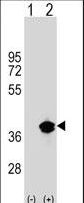 PPT1 / CLN1 Antibody - Western blot of PPT1 (arrow) using rabbit polyclonal PPT1 Antibody. 293 cell lysates (2 ug/lane) either nontransfected (Lane 1) or transiently transfected (Lane 2) with the PPT1 gene.