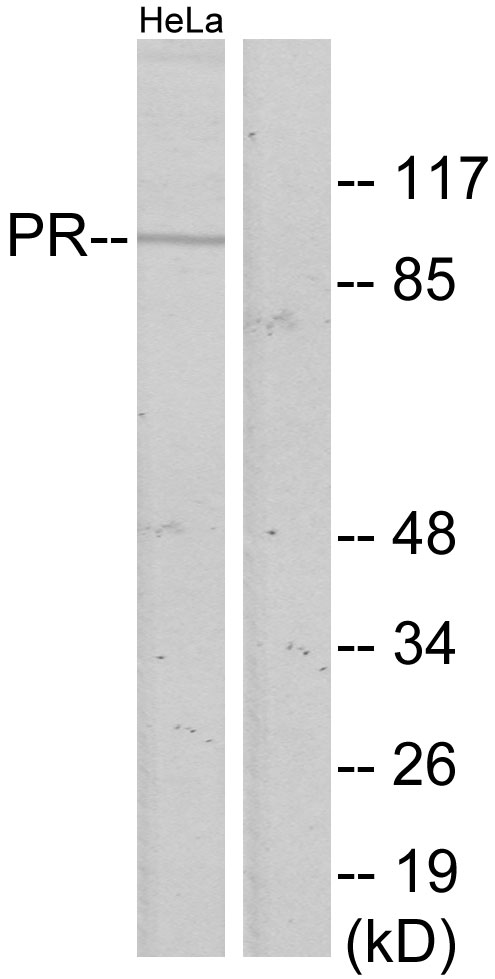 PR / Progesterone Receptor Antibody - Western blot analysis of lysates from HeLa cells, using Progesterone Receptor Antibody. The lane on the right is blocked with the synthesized peptide.