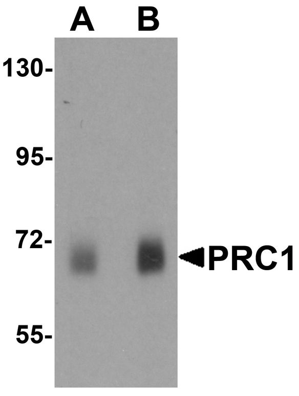 PRC1 Antibody - Western blot analysis of PRC1 in human skeletal muscle tissue lysate with Prc1 antibody at (A) 0.5 ug/ml and (B) 1 ug/ml.