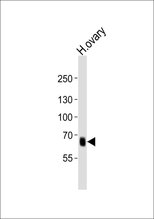 PRDM13 Antibody - Western blot of lysate from human ovary tissue lysate with PRDM13 Antibody. Antibody was diluted at 1:1000. A goat anti-rabbit IgG H&L (HRP) at 1:10000 dilution was used as the secondary antibody. Lysate at 35 ug.